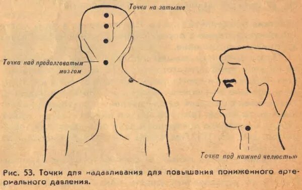 Массаж при гипотонии. Точечный массаж для понижения артериального давления. Точки для массажа от давления. Массажные точки для повышения давления. Точки массажа для повышения давления.