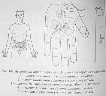 Точка терапия