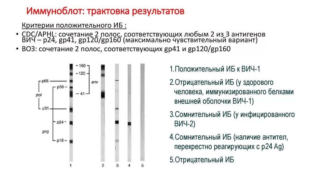 Диагностика ВИЧ инфекции иммуноблот. Иммуноблот на ВИЧ анализ. Иммуноблот на ВИЧ расшифровка анализа. Иммуноблоттинг ВИЧ анализы. Тест антиген вич