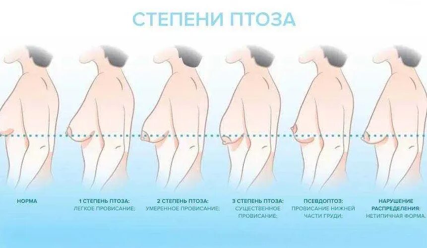Изменится ли размер