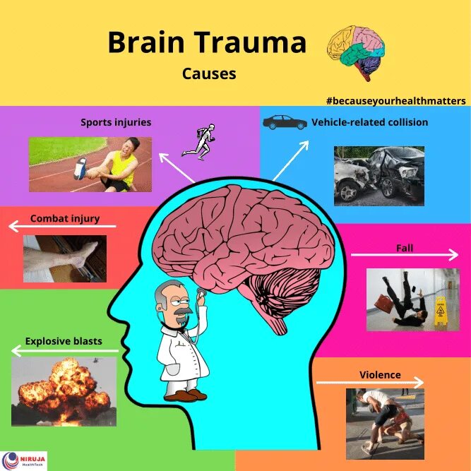 Brain Trauma Anesthesia.