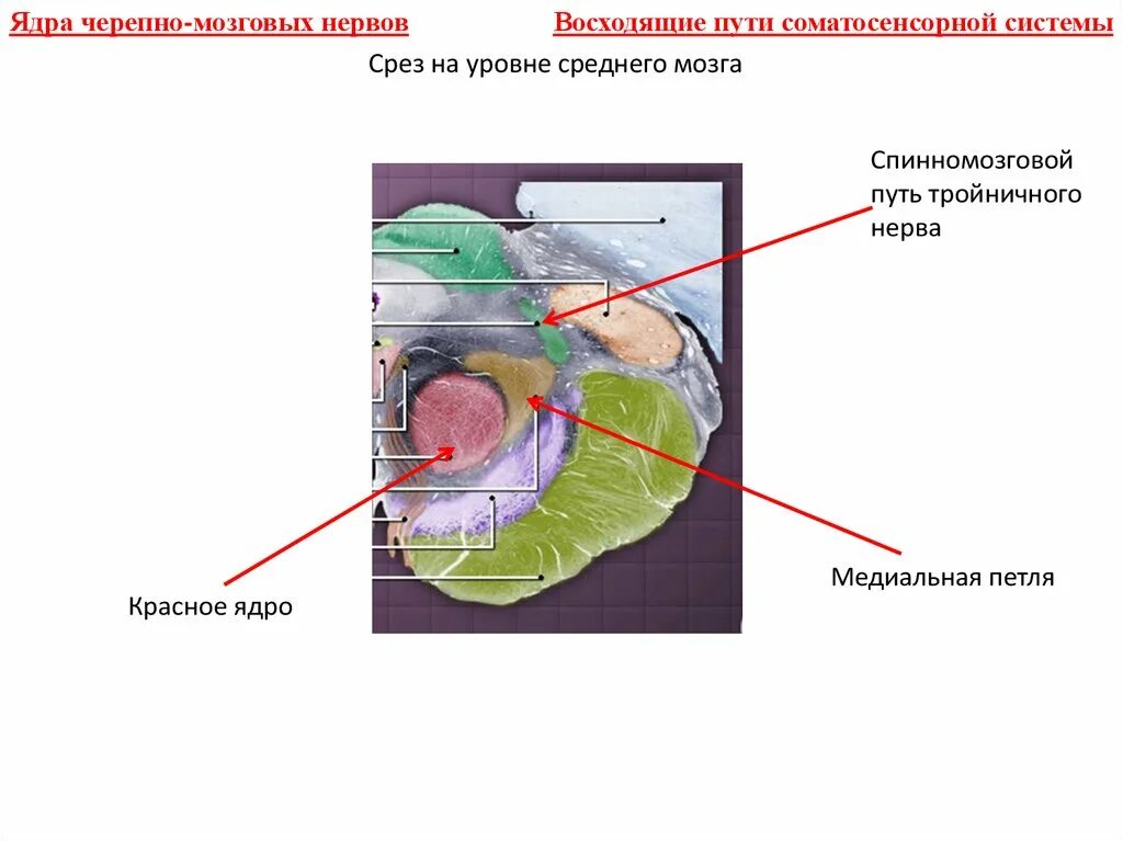 Средний мозг черепно мозговые нервы. Мезенцефальное ядротройничного нерва. Мезенцефальное ядро тройничного нерва. Срез на уровне среднего мозга. Срез среднего мозга с ядрами.