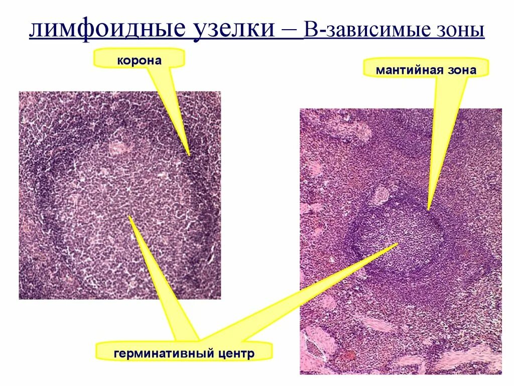 Т зависимые. Герминативный центр лимфоидного фолликула. Зоны лимфоидного узелка. Герминативный центр. Герминативный центр селезенки.