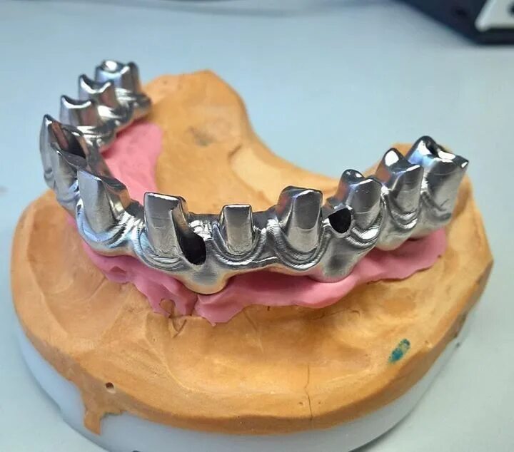 Titanium implants. Etk titanium mesh on dental implant. dental titanium bar.