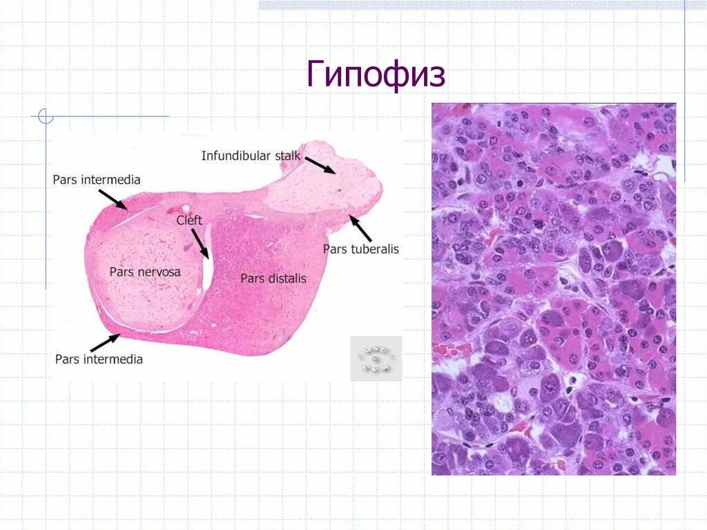 Гипофиз ткань. Гипофиз гистология препарат. Клетки гипофиза гистология.