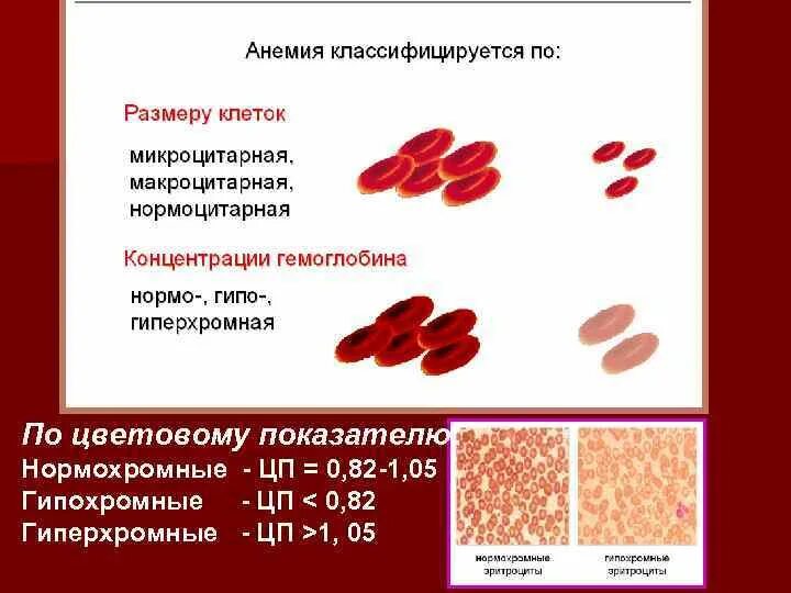 Гиперхромная анемия классификация. Цветовой показатель норма гиперхромная гипохромная. Цветовой показатель при гипохромной анемии и гиперхромной. Гиперхромная анемия цветовой показатель.