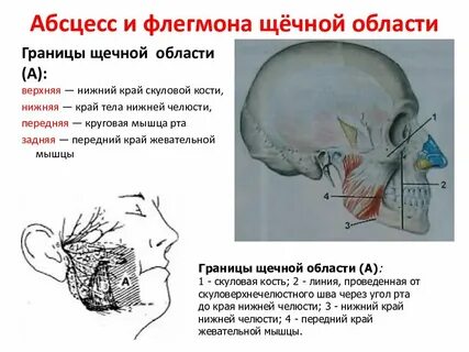 В чем отличие флегмоны от абсцесса