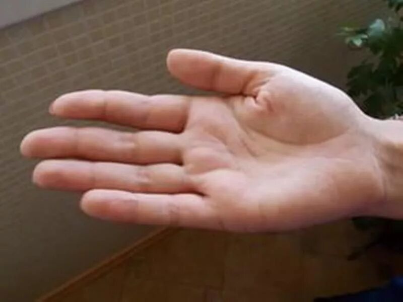 Чешутся указательные пальцы на руках