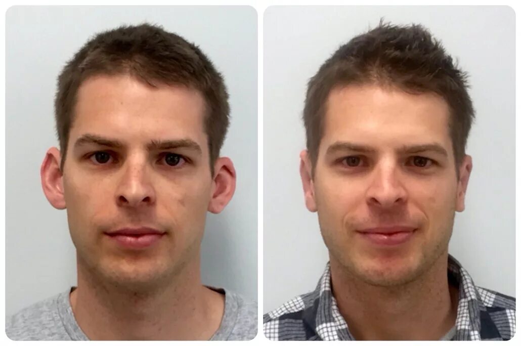 как уменьшить лицо мужчине