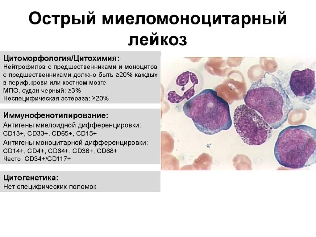 Синдромы миелолейкоза