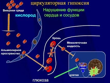 Гипоксия при нарушении кровообращения