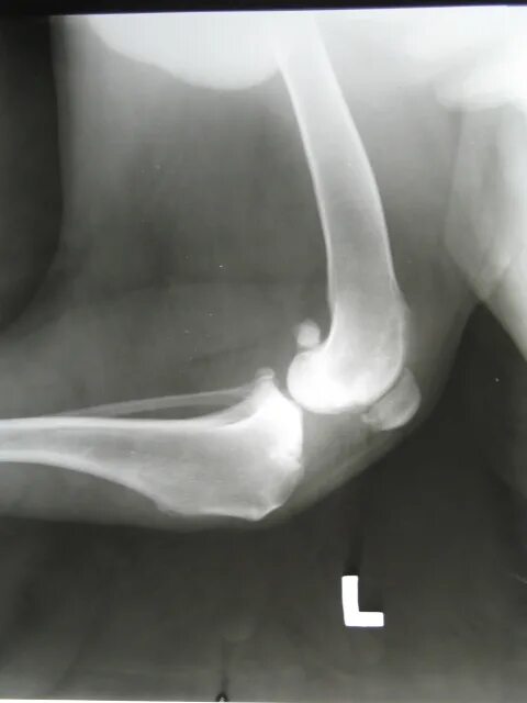 Оссифицирующий полиартрит. Остеохондродисплазия шотландских вислоухих кошек рентген. Иммуноопосредованный полиартрит у собак. Анкилоз тазобедренного сустава рентген описание. Артрит локтевого сустава у собак.