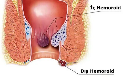Интимные вопросы- вероятность беременности от анального проникновения?