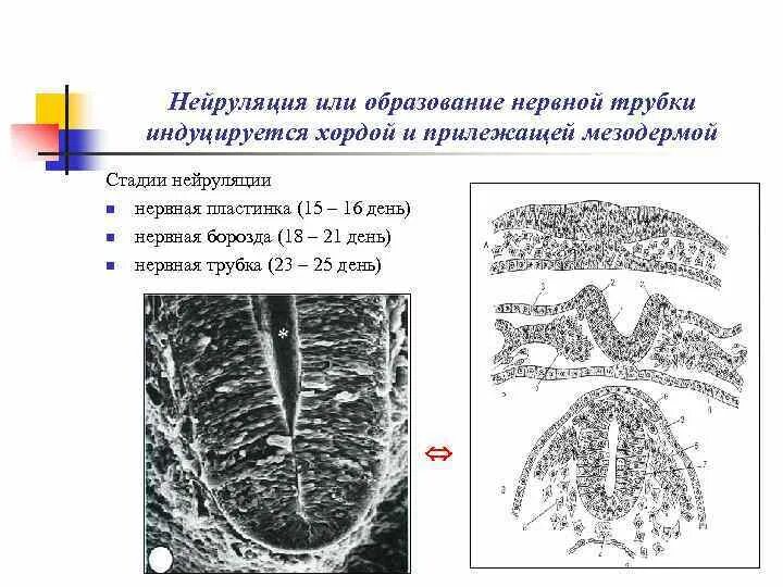 Содержит хорду и нервную пластинку