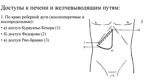 Печень на 3 см ниже реберной дуги