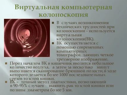 Колоноскопия при беременности