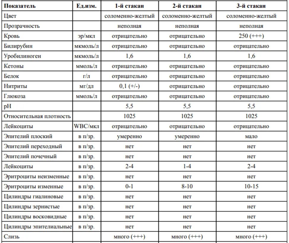 2х стаканная проба мочи расшифровка. Нормы показателей моча на диастазу. Норма диастазы в моче. 3-Х стаканная проба мочи расшифровка. Трехстаканная проба мочи