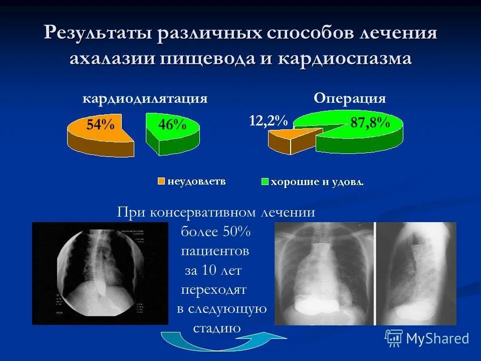 операции при кардиоспазме оперативная хирургия