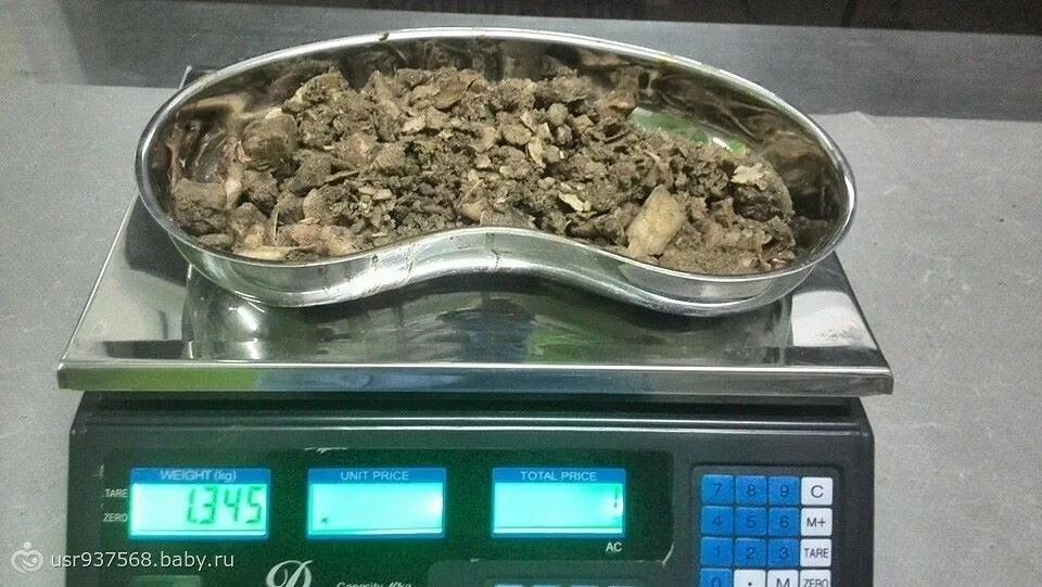 строение органов собаки. кость в желудке у собаки рентген. какие кости можно давать собаке. собакам нельзя давать кости. пластик на рентгене у собаки.