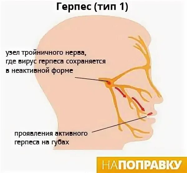 Герпес - симптомы, лечение, профилактика герпеса у взрослых