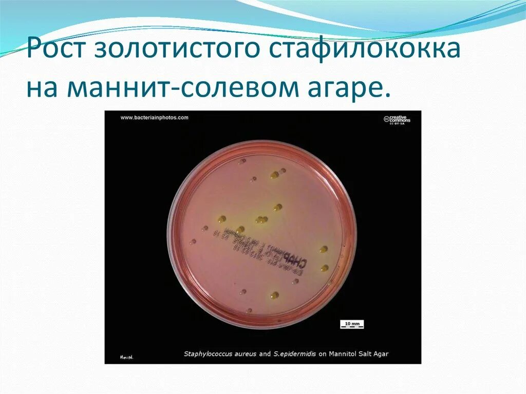 Стафилококк золотистый Staphylococcus aureus. Маннит солевой агар стафилококк. Золотистый стафилококк на маннит солевом агаре. Staphylococcus aureus степени