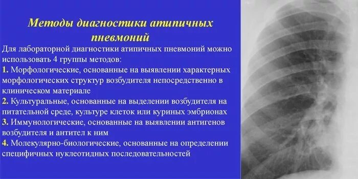 Симптомы пневмонии у взрослого человека. Основной симптом пневмонии. Скрытая пневмония у взрослого. Онкология сердца на рентгене. Односторонняя пневмония у взрослых симптомы.