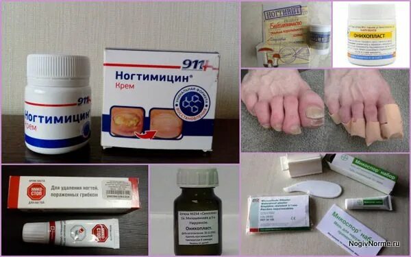 Самое дешёвое эффективное противогрибковое средство. - YouTube