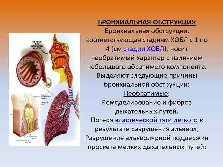 Бронхиальная обструкция выявляется с помощью. Обструкция бронхов причины. обратимая бронхиальная обструкция. необратимая бронхиальная обструкция.