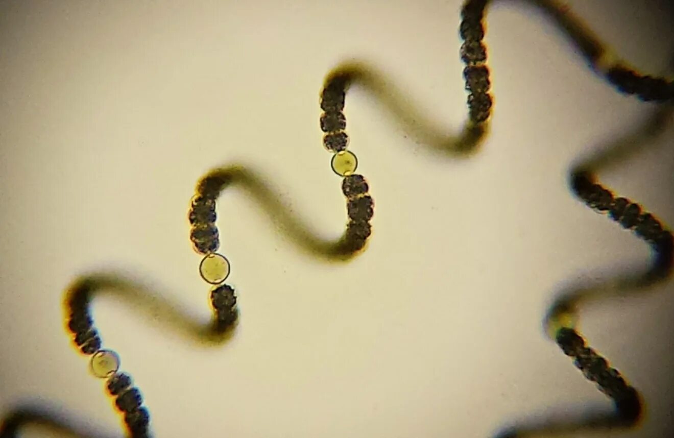 Анабена. Цианобактерия anabaena. anabaena spiroides. акинеты anabaena. анабена водоросли.
