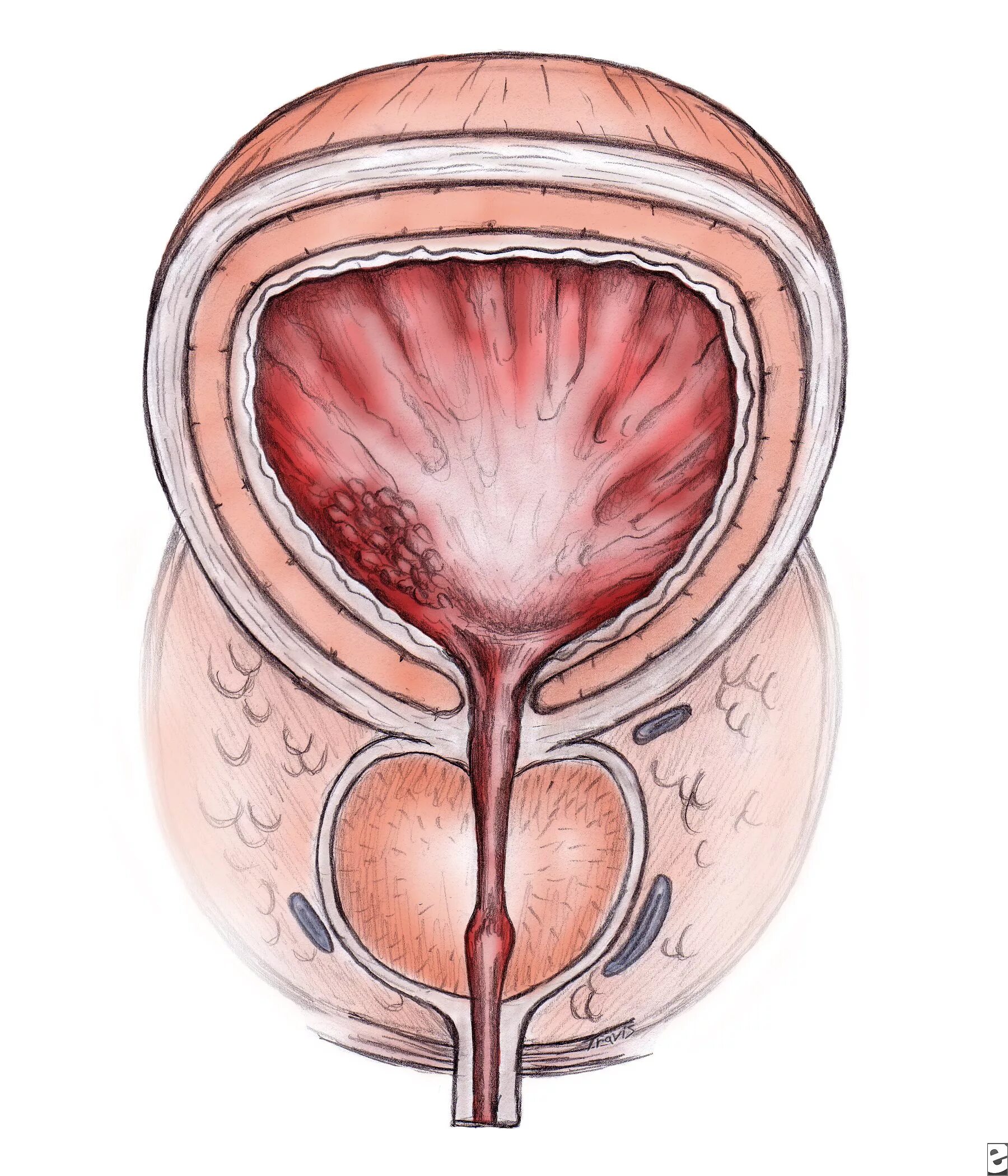 Предстательная железа, Prostata. Простатит предстательной железы. Простата и предстательная железа. Простата это предстательная