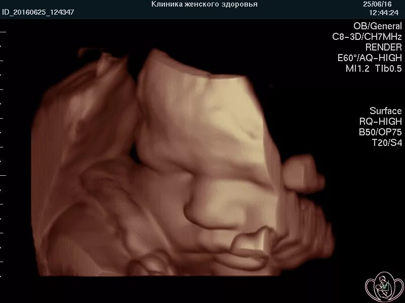 4д УЗИ на 25 неделе беременности. 3д УЗИ при беременности 25 недель. 30 Недель беременности 4 д УЗИ.