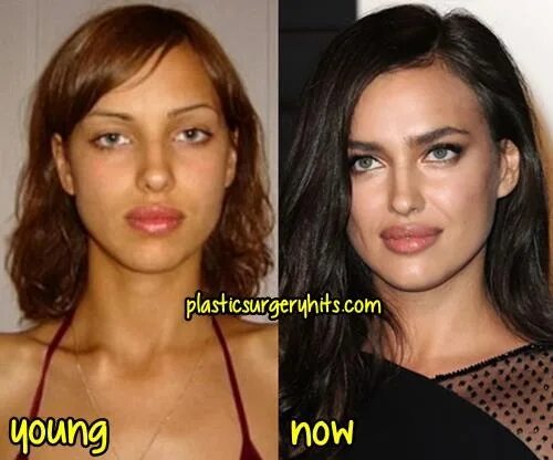 Шейк до и после. Irina Shayk before.