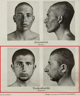 Расовые типы