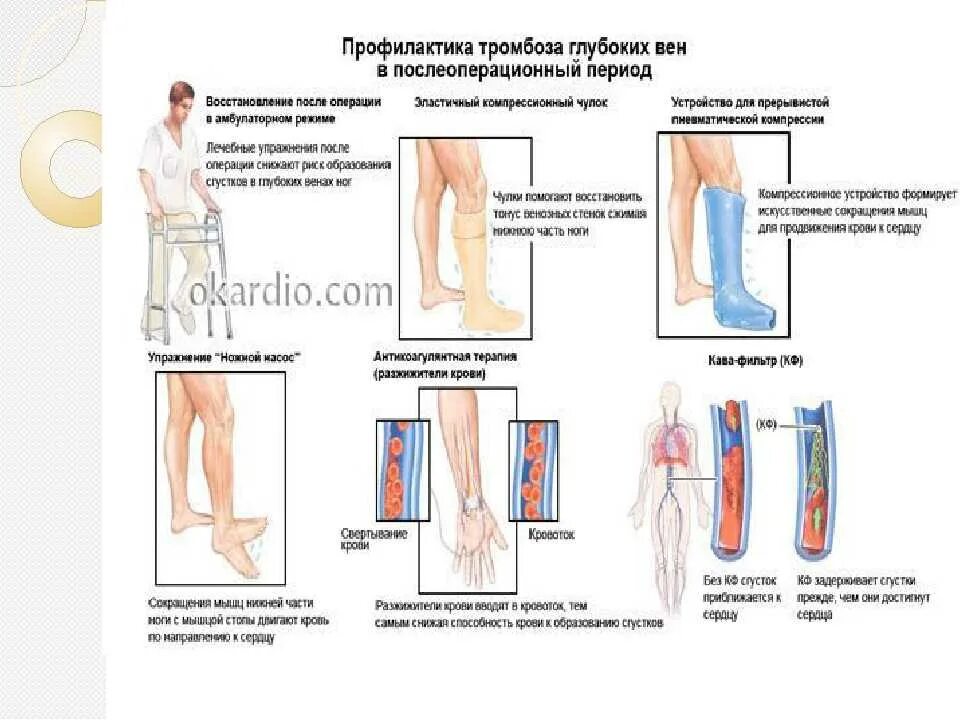 Профилактика тромбоза глубоких вен после флебэктомии. Профилактика тромбоза вен нижних конечностей. Варикозное расширение вен нижних конечностей классификация. Тромбоз глубоких вен нижних конечностей схема. Схемы лечения тромбофлебита нижних конечностей