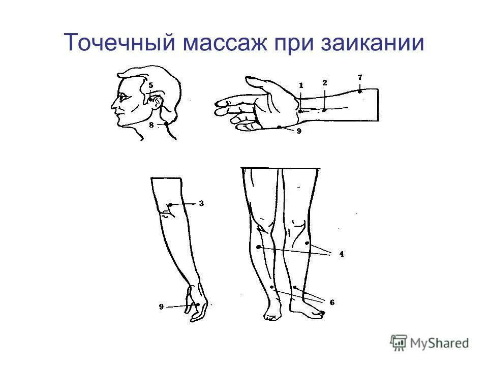 Точечный массаж при заикании у детей схема. Точечный массаж от заикания для детей. Точечный массаж при заикании точки. Точечный массаж при заикании у детей.