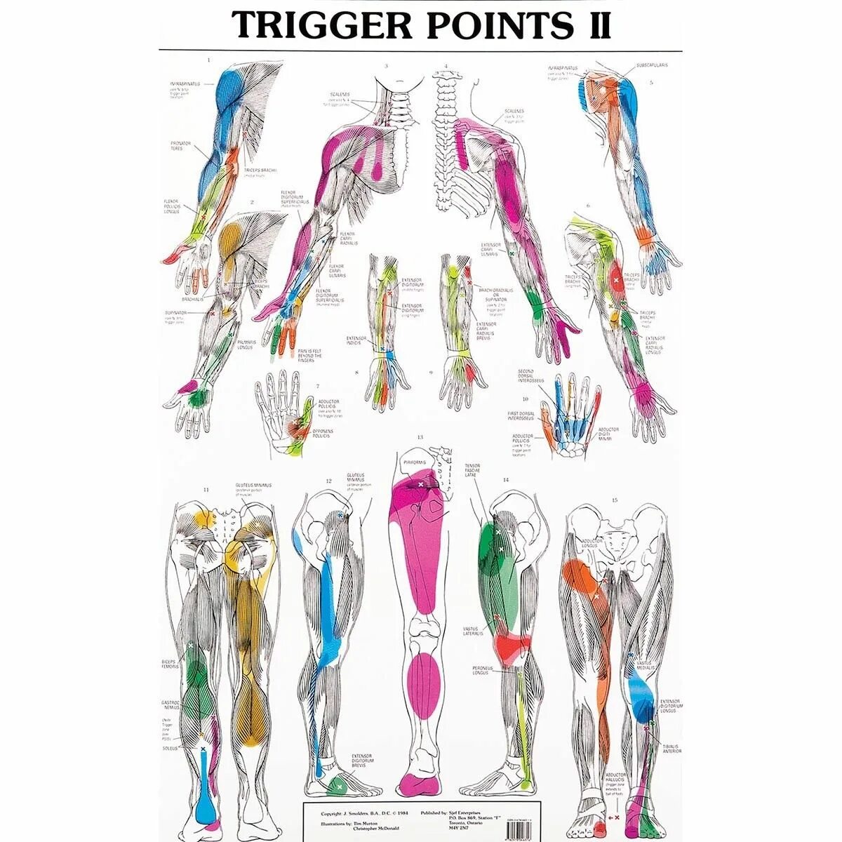 Trigger lines