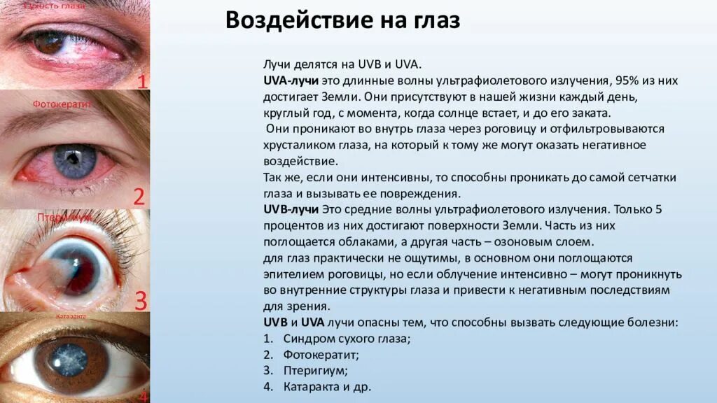 Можно ли после солнечного. Влияние ультрафиолетовых лучей на глаза человека. Ультрафиолетовое излучение влияние на глаза. УФ излучение влияние на глаза. Влияние УФ лучей на глаза.