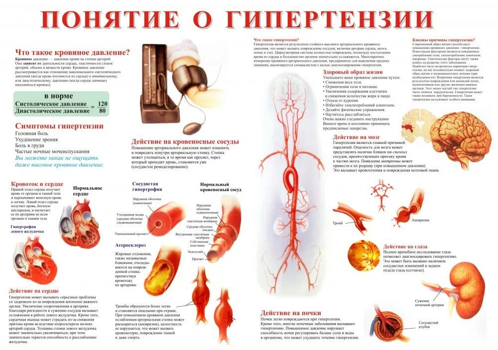 Гипертония термин. Гипертония понятие. Понятие о гипертонических. Гипертония дать понятие. Понятие о гипертензии PNG.