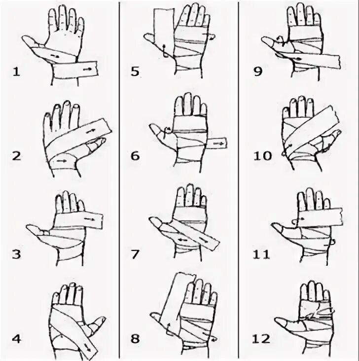 Как правильно забинтовать кисть руки марлевым бинтом. Как правильно эластичным бинтом забинтовать кисть. Правильно забинтовать руку эластичным бинтом. Схемы бинтования запястья эластичного бинта. Как перевязать кисть