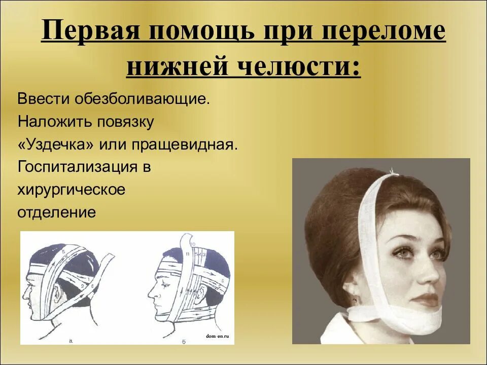 При переломе нижней челюсти необходима повязка