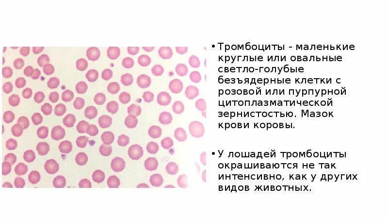 Тромбоциты безъядерные фрагменты клеток. Тромбоциты мазок крови. макротромбоциты в крови у человека. оценка тромбоцитов в мазке крови. подсчет тромбоцитов в мазке крови.