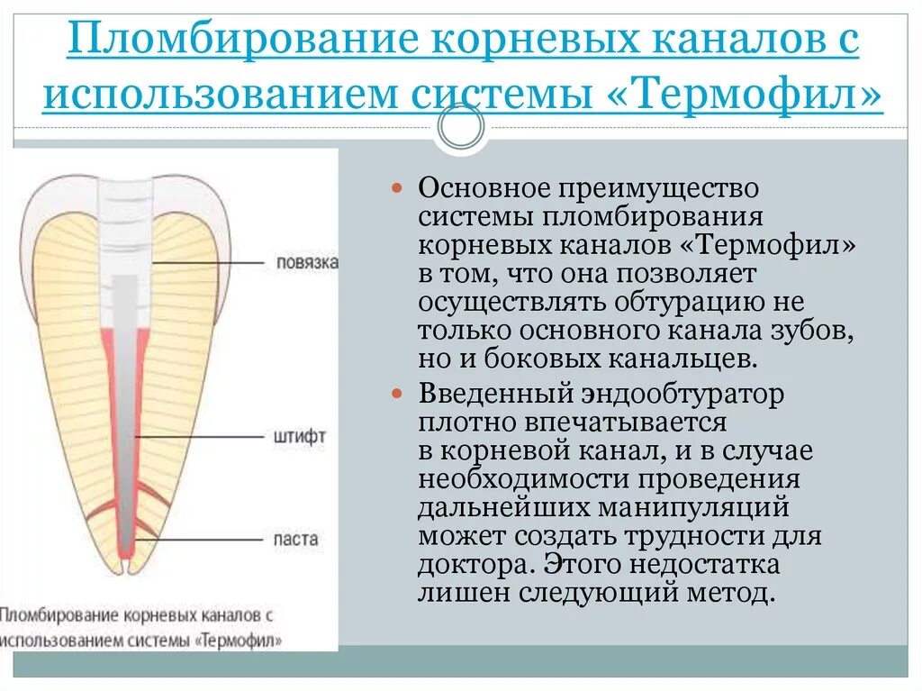 Пломбировочная система корневых каналов «Термафил».. Система Термофил гуттаперча. Комбинированные методики пломбирования корневых каналов зуба. Термофил методика пломбирования. Пломбировка корневых каналов