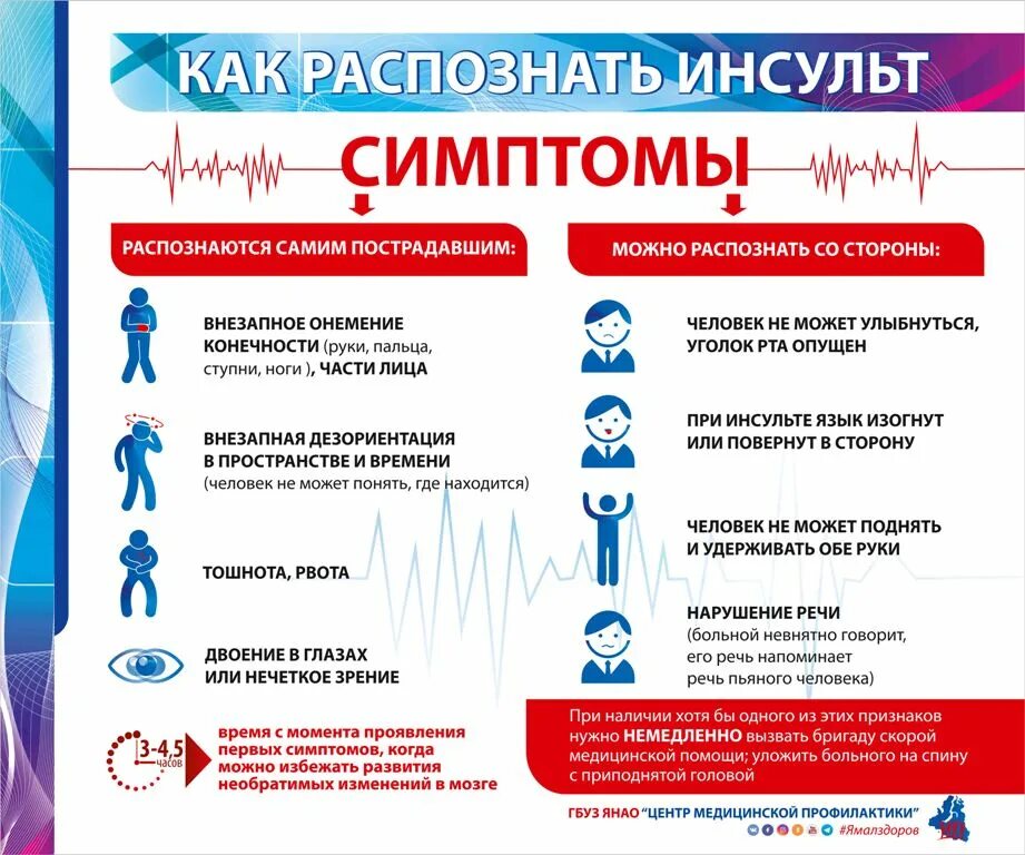 Первые признаки прединсульта у женщины