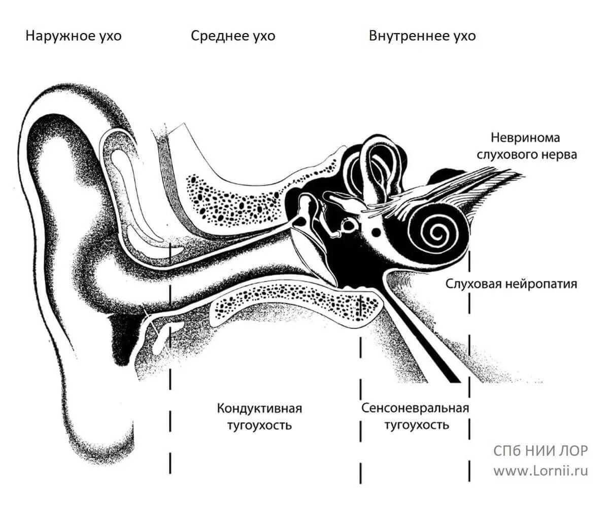 Нерв внутреннего уха. Строение внутреннего уха человека слуховой нерв. Барабанная перепонка при тугоухости. Строение уха слуховой нерв. Нервы органа слуха