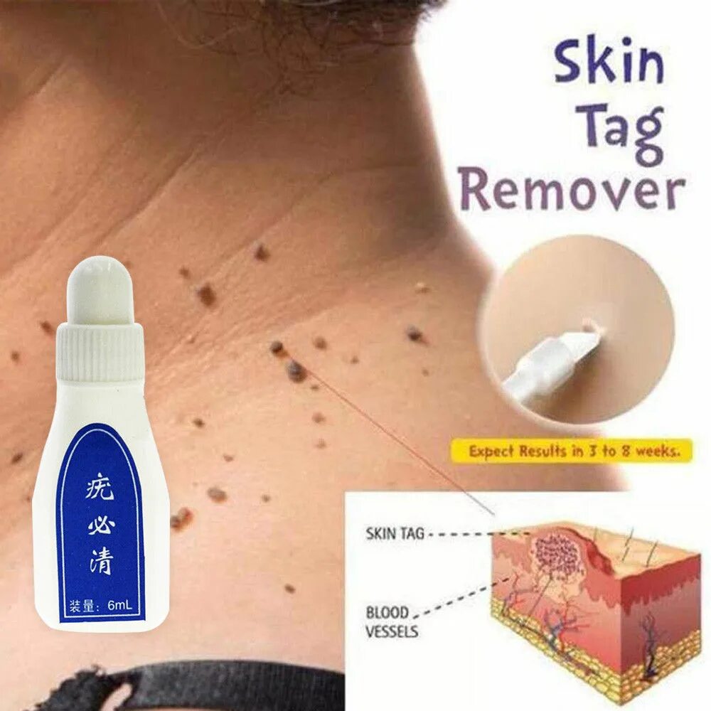 Remove tags. Remove tags