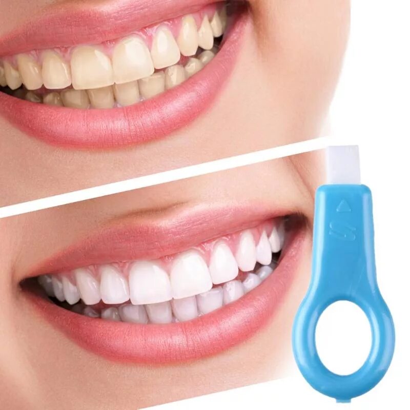 Отбеливание зубов Teeth Whitening Kit. Карандаш для отбеливания зубов. Белые зубы. Профессиональное отбеливание.