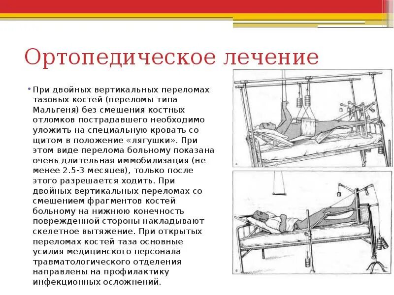 Как проходят операции при переломе