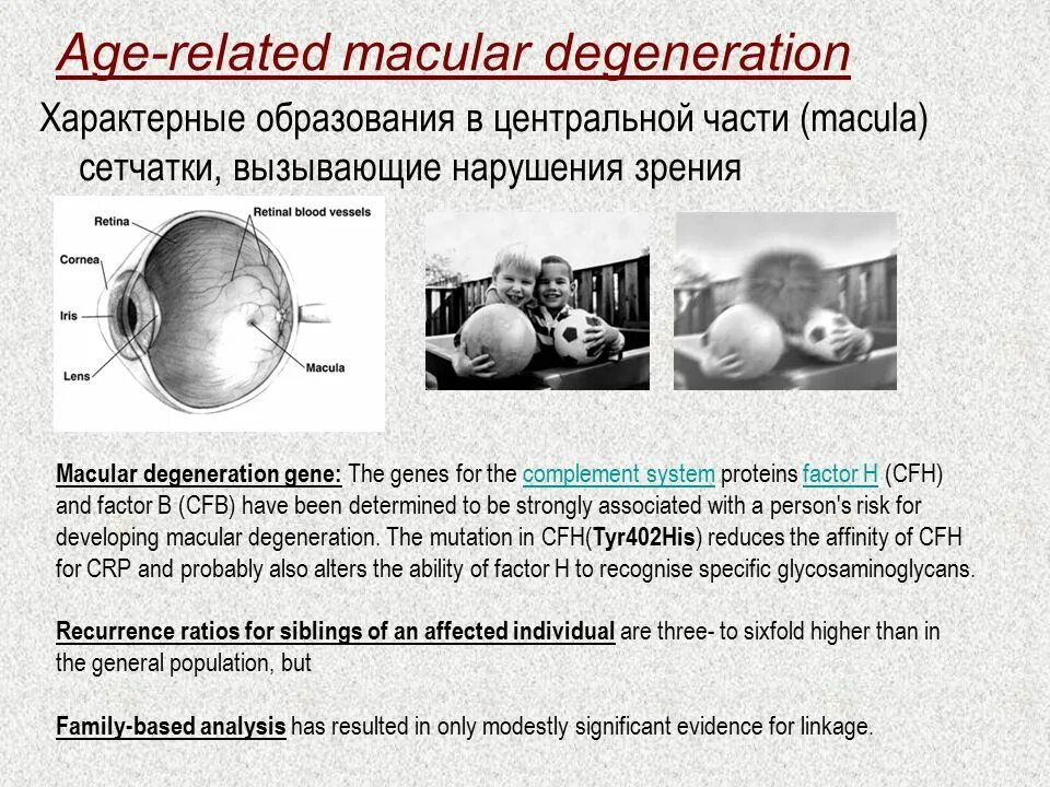 Types of Macular Degeneration. Macular hole по GASЫ classification. Why sparing Macula in PCA.