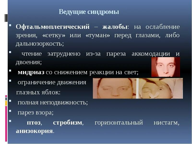 Жалобы на двоение в глазах. Ведущие синдромы. Ботулизм офтальмоплегический синдром. Ведущий синдром это.