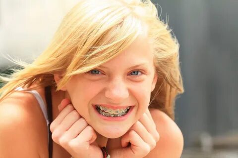 Invisalign vs Braces - Kidtastic Pediatric Dental & Orthodontics City.